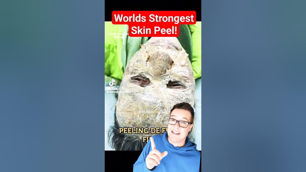 WORLDS STRONGEST SKIN PEEL - Phenol Peel Process #shorts WORLDS STRONGEST SKIN PEEL - Phenol Peel Process #shorts