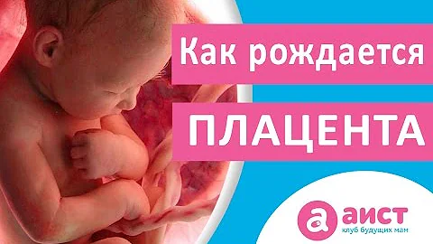 Рождение плаценты или как родить послед