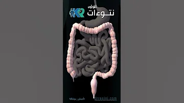 علاقة التشنجات العضلية بنتوءات القولون 
