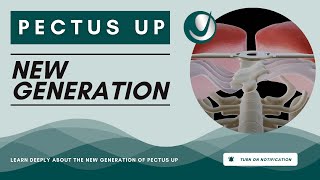Pectus Up New Generation - Pectus Excavatum Surgical Procedure