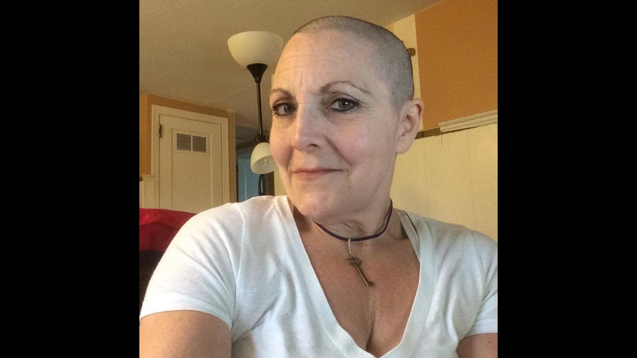 Thin Hair No More I Shaved My Head Youtube