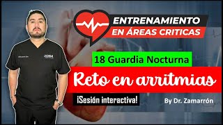 18 Guardia Nocturna // Reto en arritmias graves By Dr. Zamarrón
