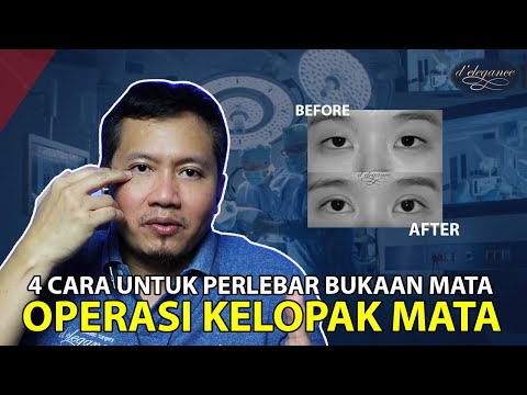 Video: 6 Cara Membuat Mata Asia Nampak Lebih Besar