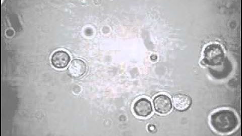 Spinning, Rotating and Dancing Collision of Liver Cells-MSCL Lab (Optoelectronic Tweezers, OET)