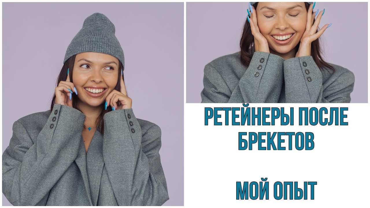 НУЖНО ЛИ УСТАНАВЛИВАТЬ РЕТЕЙНЕРЫ ПОСЛЕ БРЕКЕТОВ? ПРОБЛЕМЫ НОСКИ ...