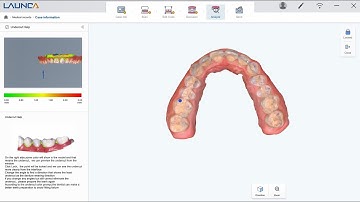 DL-300 Set up and Scanning Tutorial