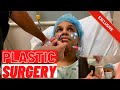 FFS | PLASTIC SURGERY VLOG PT.2 | OFFICIAL TATI