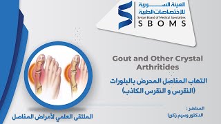 التهاب المفاصل المحرض بالبلورات (النقرس و النقرس الكاذب _ Gout and Other Crystal Arthritides
