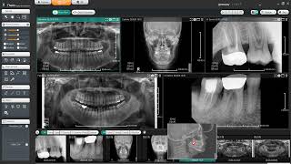 Theia Genoray Papaya CBCT Software Customizing Layout 1