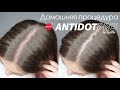 AntiDot: устранение раздражения кожи головы. Домашняя процедура