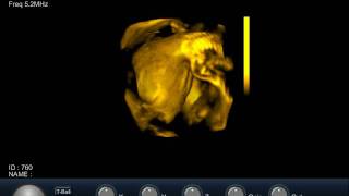 4D fetus 34 weeks.avi