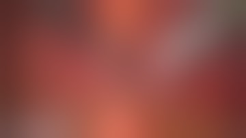 Basic Skills_2018: Catheter Insertion