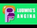 What is Ludwig's Angina?