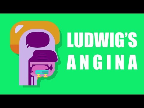 What is Ludwig&rsquo;s Angina?