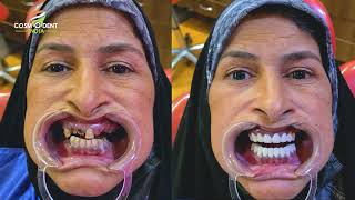 أفضل عيادة أسنان في الهند لزراعة الأسنان في نيودلهي