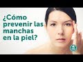 ¡Como prevenir las manchas en la piel!