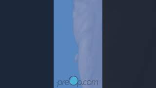 PreOp® 🤖 Master Robotic Prostate Surgery Insights #preop #shorts #health 🎥
