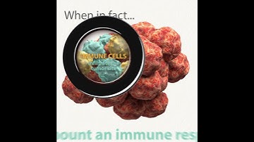 IOU YouTube: What is pseudo-progression?