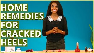 Cracked Heels Treatment – Home Remedies To Get Rid Of Dry \& Cracked Feet