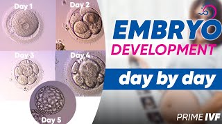 Embryo Development Day By Day in Hindi | Best Blastocyst Clinic in Gurgaon | Prime IVF
