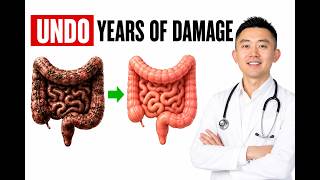Gut Detox: The Fastest Way To Repair Your Gut Naturally (Backed by Science)