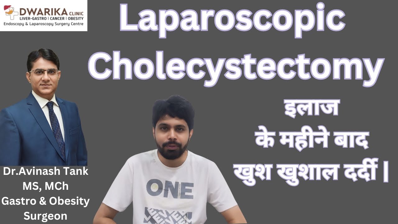 Gall-Bladder Removal Treatment Dr Avinash Tank, Dwarika Clinic, Ahmedabad