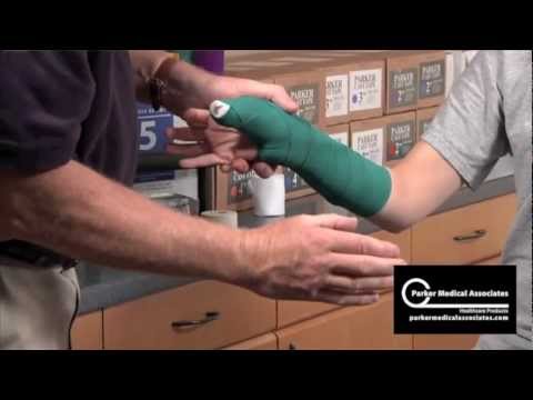 Thumb Spica Splint Technique - YouTube