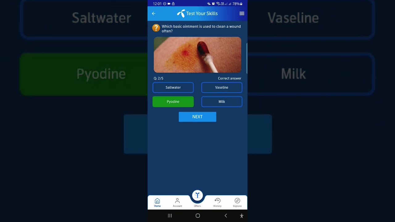 17 July  2025  Questions and Answers | My Telenor Today Questions | Telenor Questions Today Quiz
