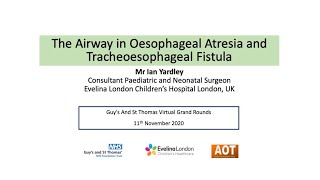 Paeds Ent The Airway In Oesophageal Atresia And Tracheoesophageal Fistula Mr Ian Yardley