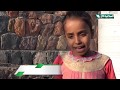 سنابل الخير - طفلة يتيمة تعاني من إعاقة بسبب الحرب  27-1-2020م