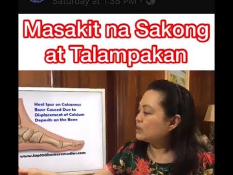 How to treat feet and heel pain - by Doc Liza Ong