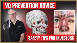 Vascular Occlusion & Necrosis Prevention | Dermal Filler Safety Advice for Injectors