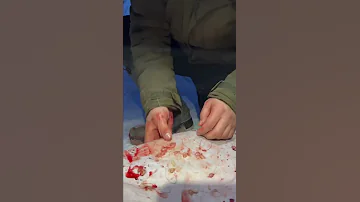 Deer gadfly larvae🦌/ Личинки овода у оленя🦌