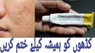 Contractubex Gel Best Treatment Of Scars. How To Fill Acne Scars.