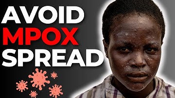 Mpox: What are the symptoms, and how does it spread?