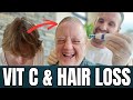 My Sister's Battle With Telogen Effluvium (Hair Shedding) Due To Vitamin C Deficiency