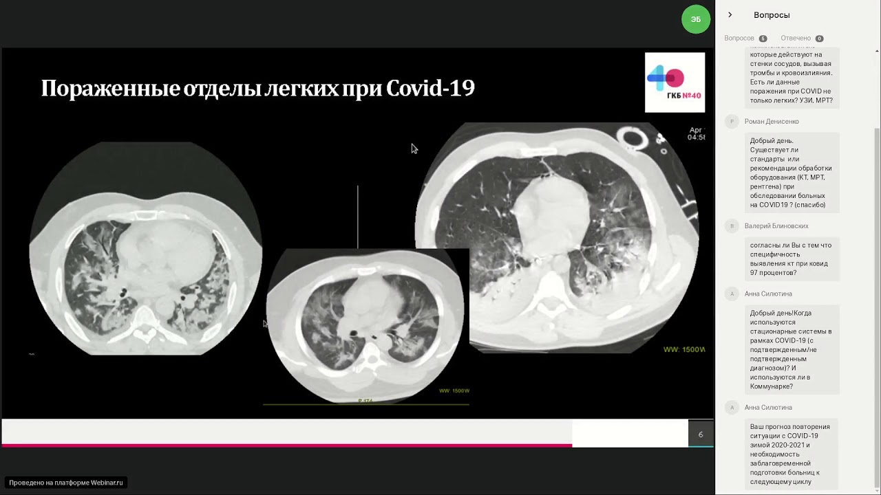 Как Выглядят Легкие Здорового Человека Фото