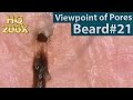 #21 Pull Out Beard(Viewpoint of Pores), Blackhead and Hair Root(Root Sheath) Close up