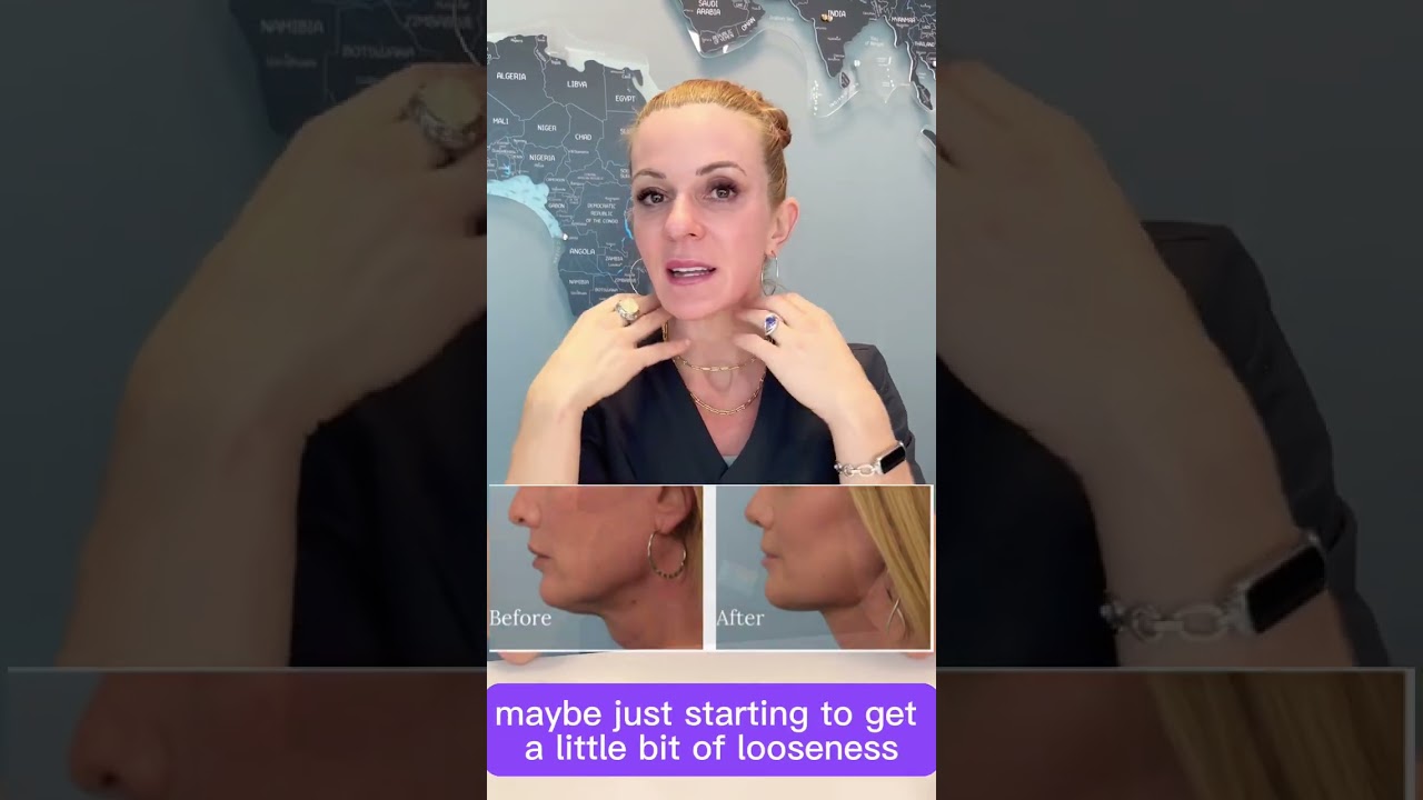 Renuvion, Facelift, which one?? | Dr. Regina Rodman Houston TX