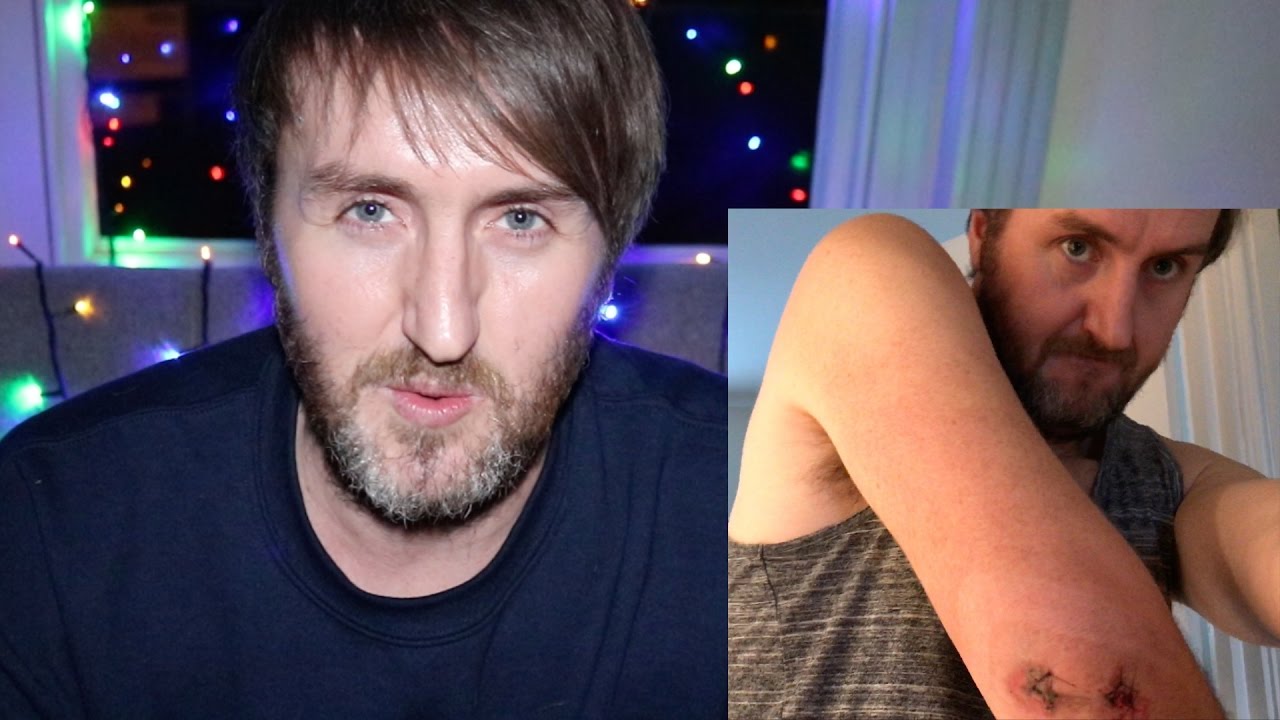 THE ELECTRIC SKATEBOARD ACCIDENT YouTube