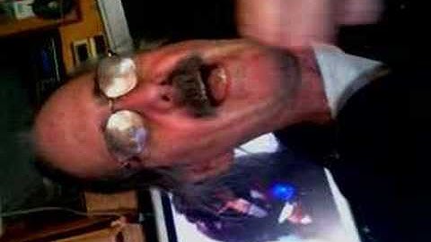 Chronosynclastic infundibulum