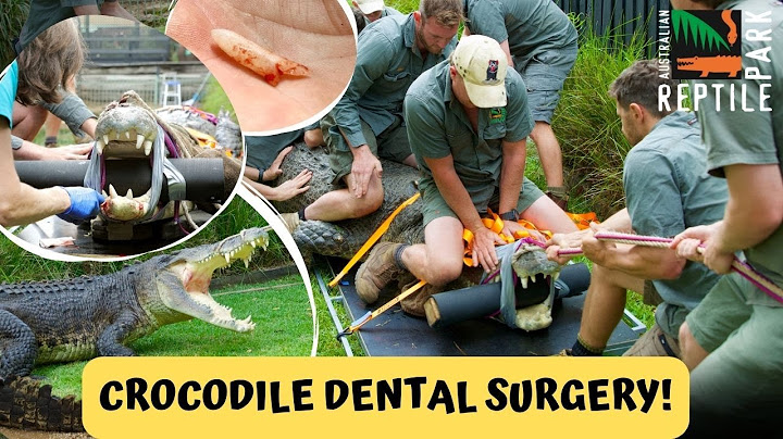 CROCODILE DENTAL SURGERY on Elvis - Australia's Crankiest Croc!