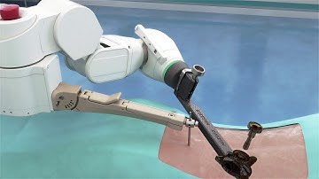 Mazor X™ Scan & Plan