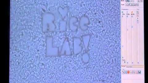 Laser Capture Microdissection of HCV Infected Cells