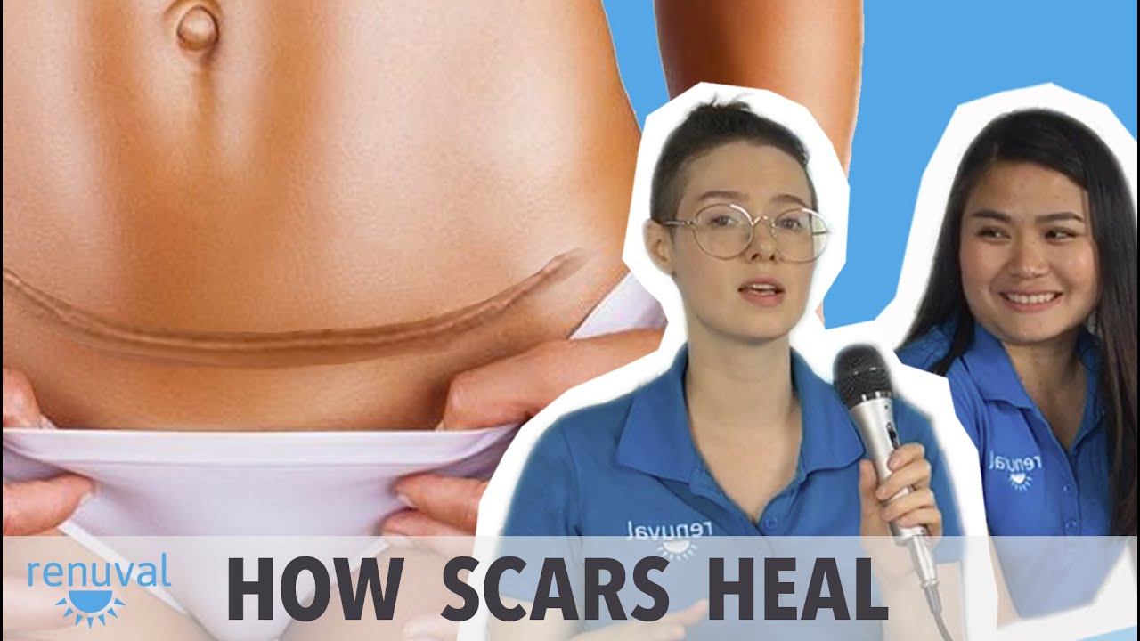 What About The Scar? Plastic Surgery's Mark VidPod