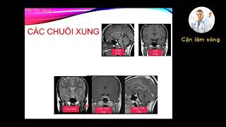 HÌNH ẢNH TUYẾN YÊN BÌNH THƯỜNG TRÊN MRI | ThS. BS. Nguyễn Thị Tố Quyên