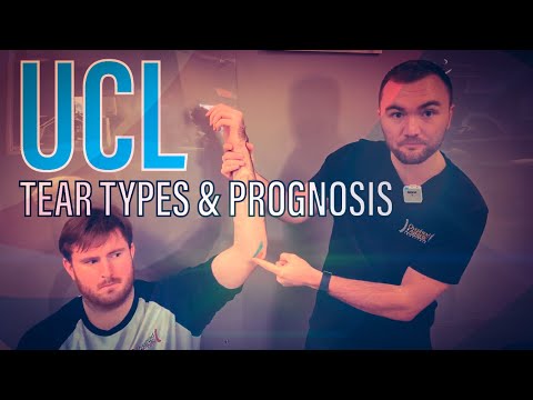 UCL Tear: Types and Prognosis