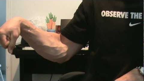 FOREARMS 15 1/2 inches 17 yrs