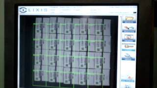 Lixis Aggregation Module 2