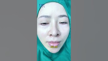 Cắt Mí Dưới , Dàn Mỡ Trẻ Hoá Mắt ( Bác Sĩ Ninh Đông)